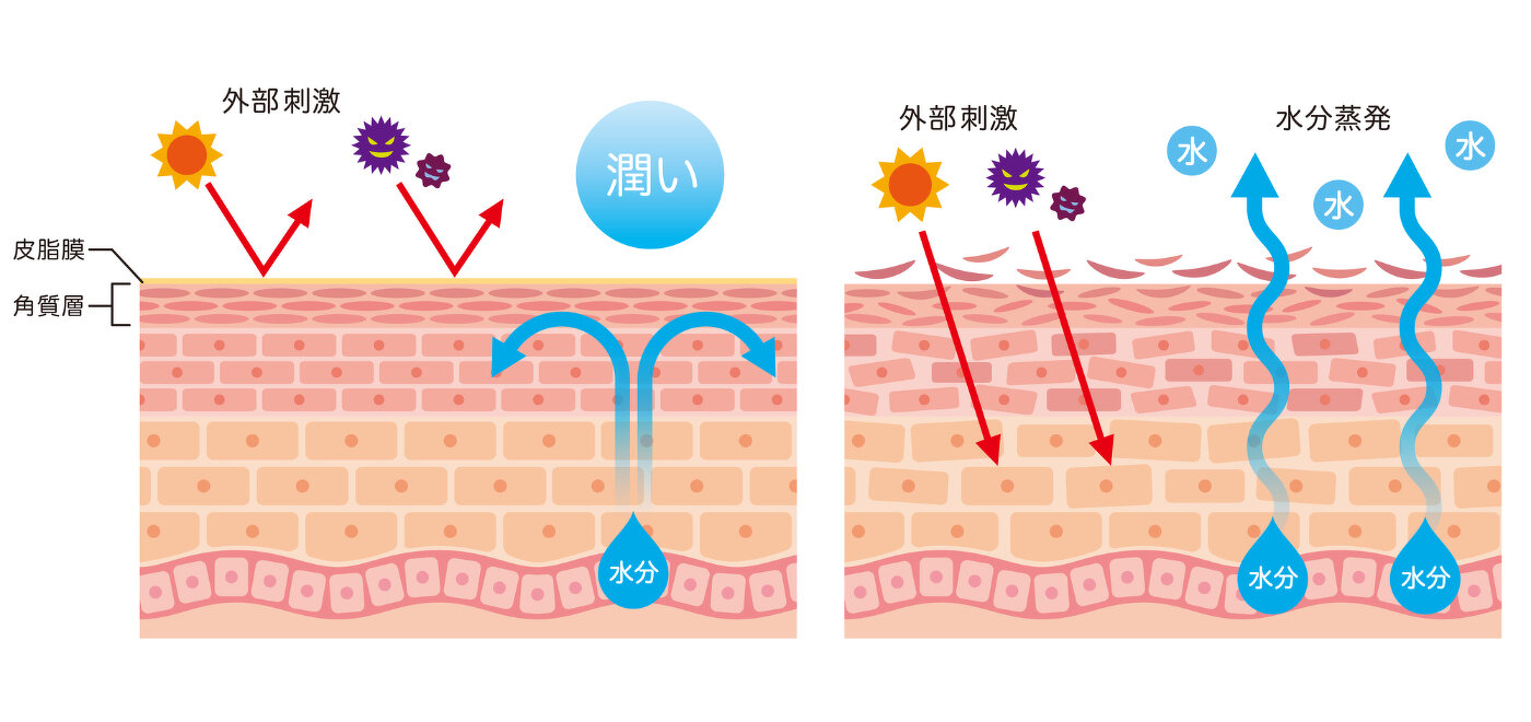 妊娠中は肌が乾燥しがち 肌トラブルの原因を知って上手にケア マタニティケア 妊娠 育児のお役立ちコラム アラウ ベビー