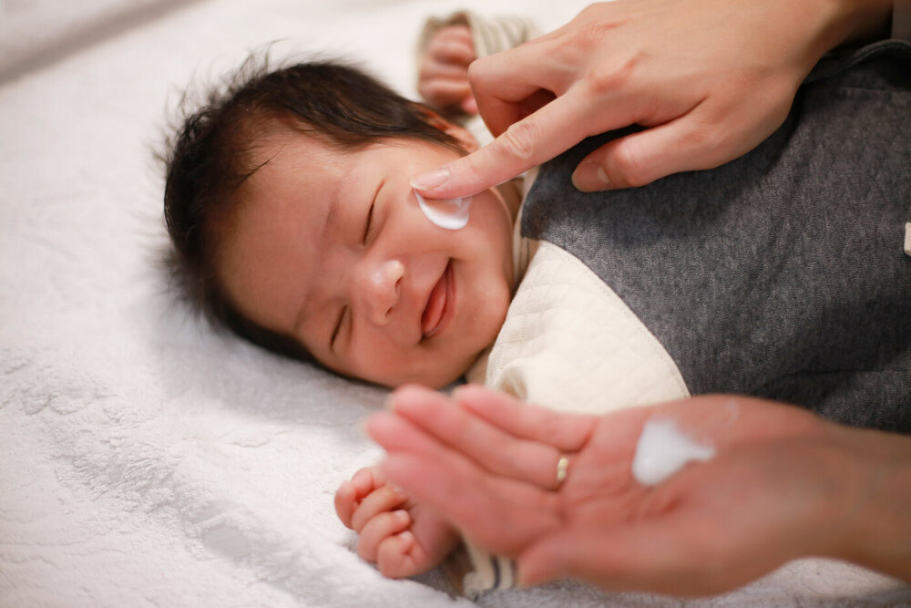 赤ちゃんの顔に乳児湿疹ができたときの対処法