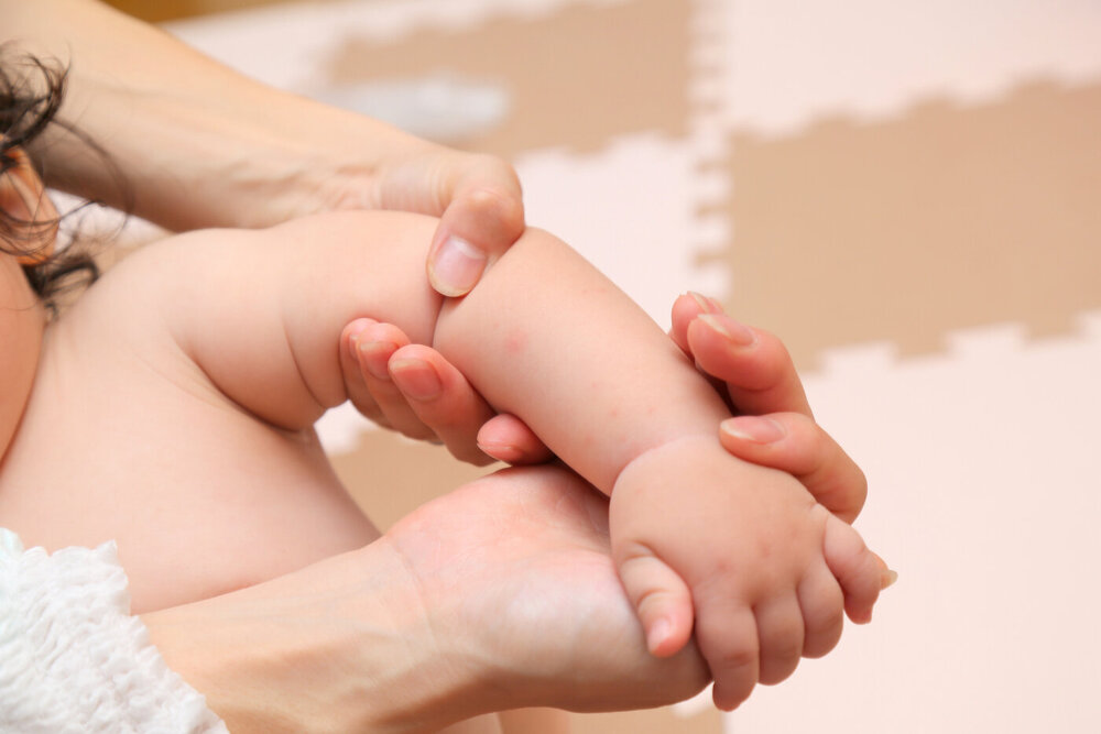 赤ちゃんのあせものケア＆予防方法