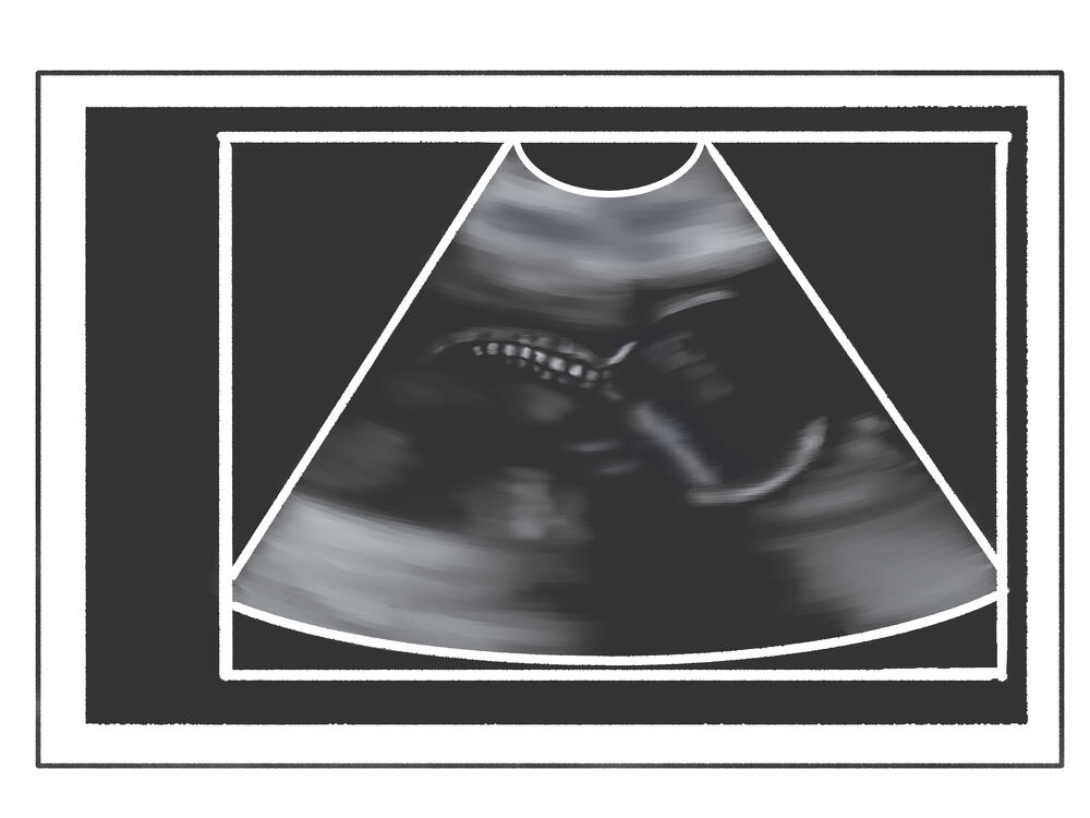 妊娠21週目頃の赤ちゃんの様子