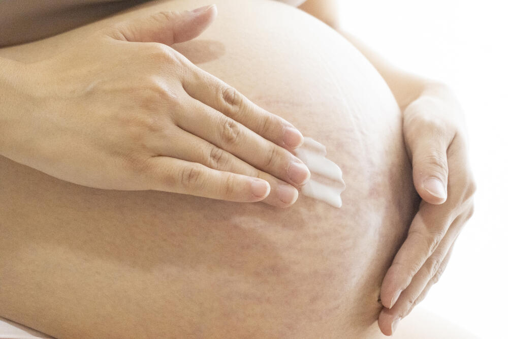 妊娠線の効果的な予防方法は？